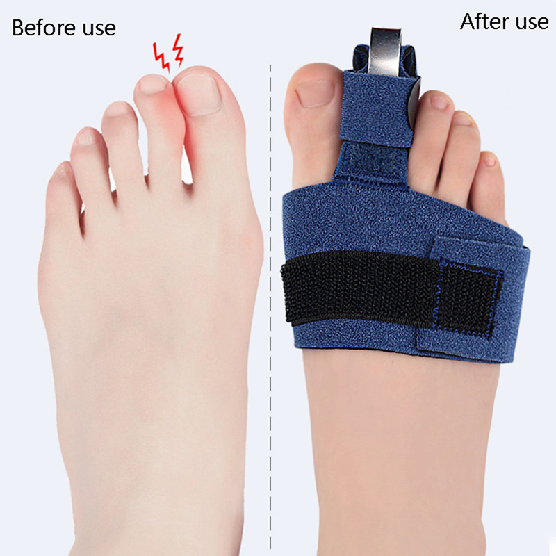 1개입 발가락 교정기, 발가락 골절 고정기, 정형외과용 - Ankle Brace Sock 리뷰 및 가격