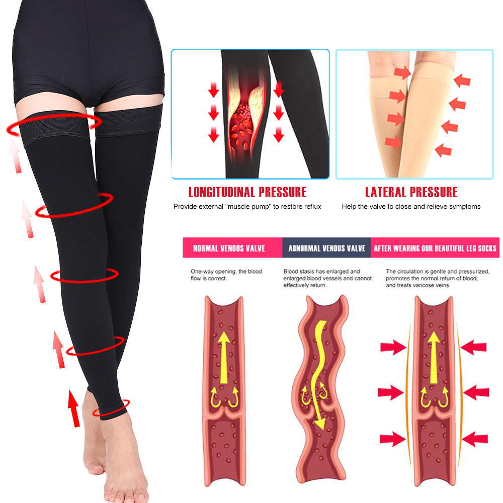 오픈 발가락 무릎 높이 의료 압축 스타킹 정맥류 스타킹 - Compression Sock Medical 리뷰 및 가격